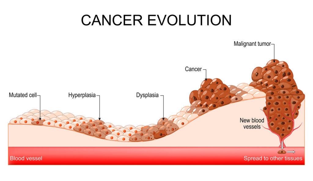 cancer evolution - image
